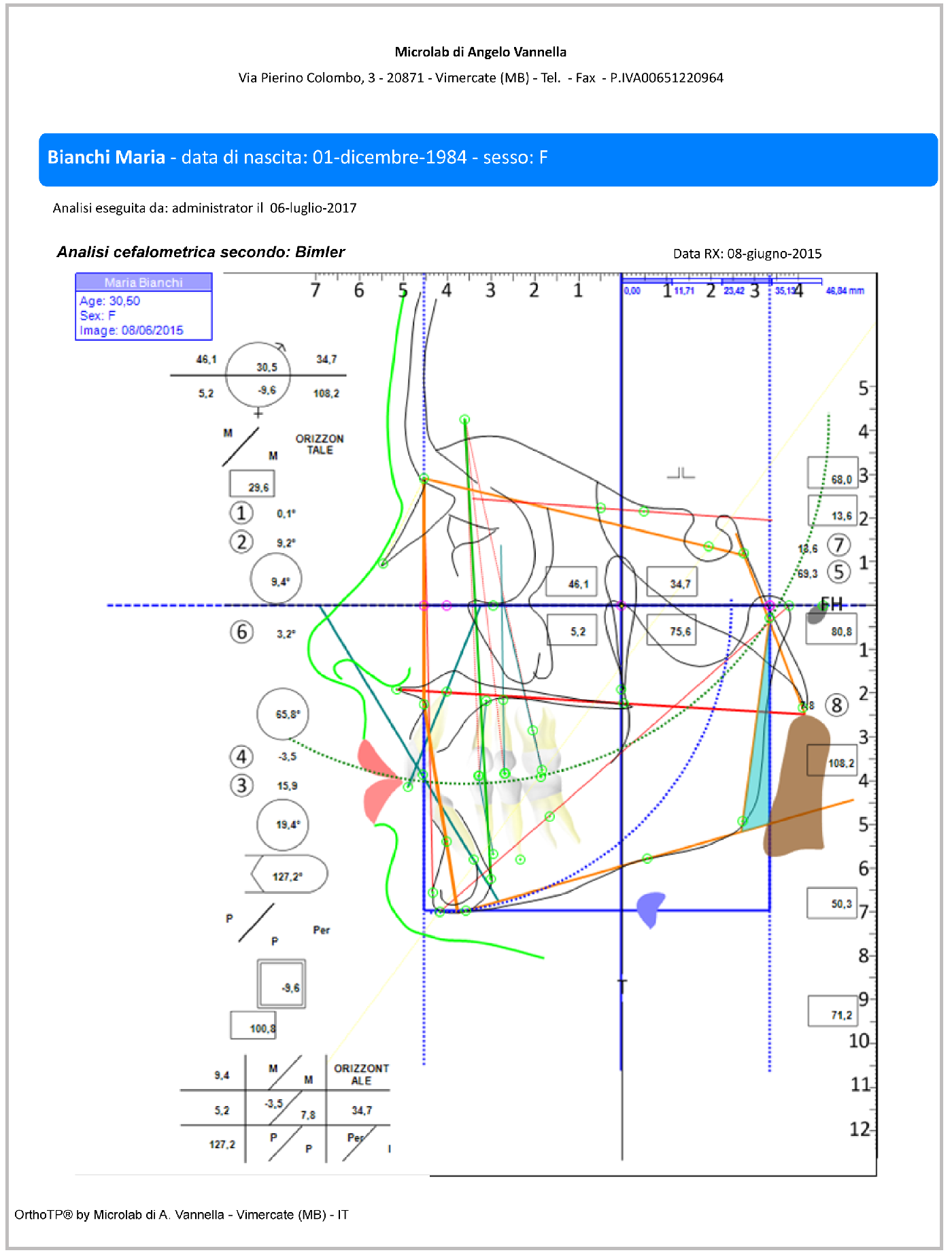 Calcografia di Planas