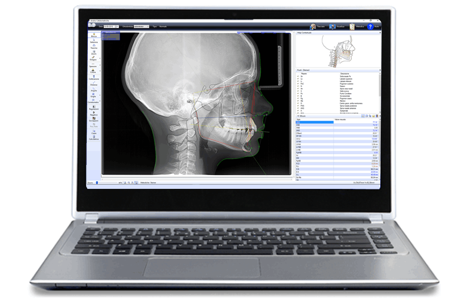 Programma cefalometria e cartella ortodontica